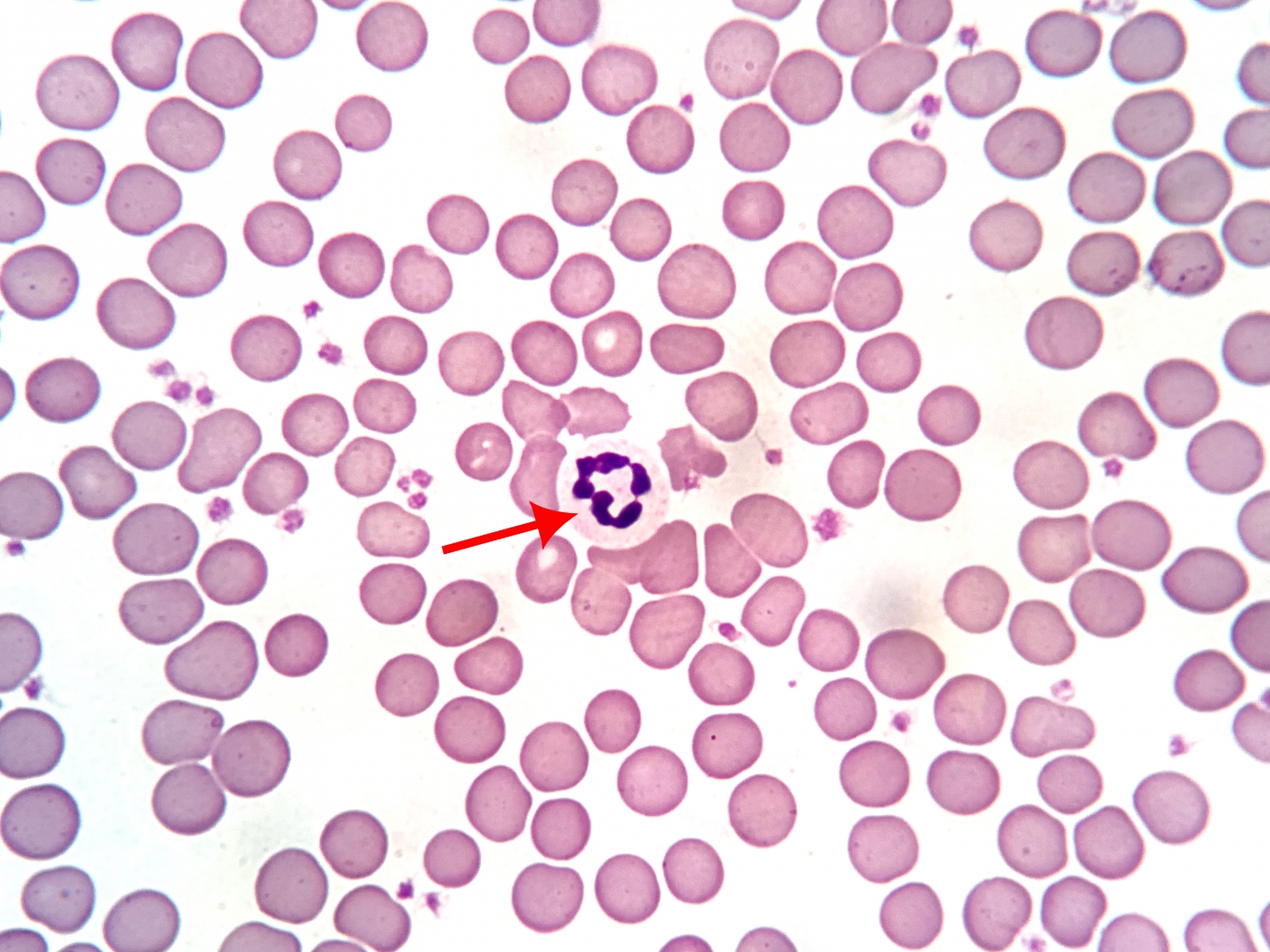 healthy red and white giant panda blood cells