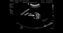 Veterinarians at the Smithsonian’s National Zoo detected tissue consistent with fetal development during giant panda Mei Xiang’s ultrasound this morning, Aug. 14. a black and white ultrasound image with arrow indicating the placement of a giant panda fetus in-utero