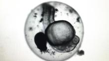 This image illustrates the first-ever reproducible evidence for the successful cryopreservation of zebrafish embryos. The study uses new gold nanotechnology and lasers to thaw the embryo—the stumbling block in previous studies, and it has profound implications for human health, wildlife conservation and aquaculture. Black-and-white image of a zebrafish embryo under a microscope